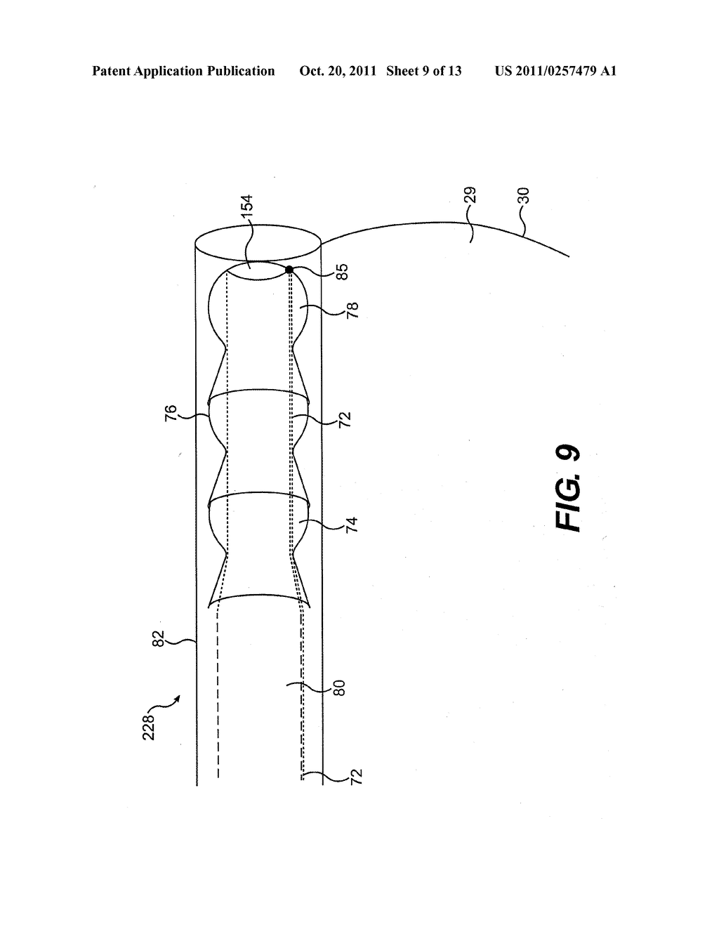 CONTROLLABLE ENDOSCOPIC SHEATH APPARATUS AND RELATED METHOD OF USE - diagram, schematic, and image 10