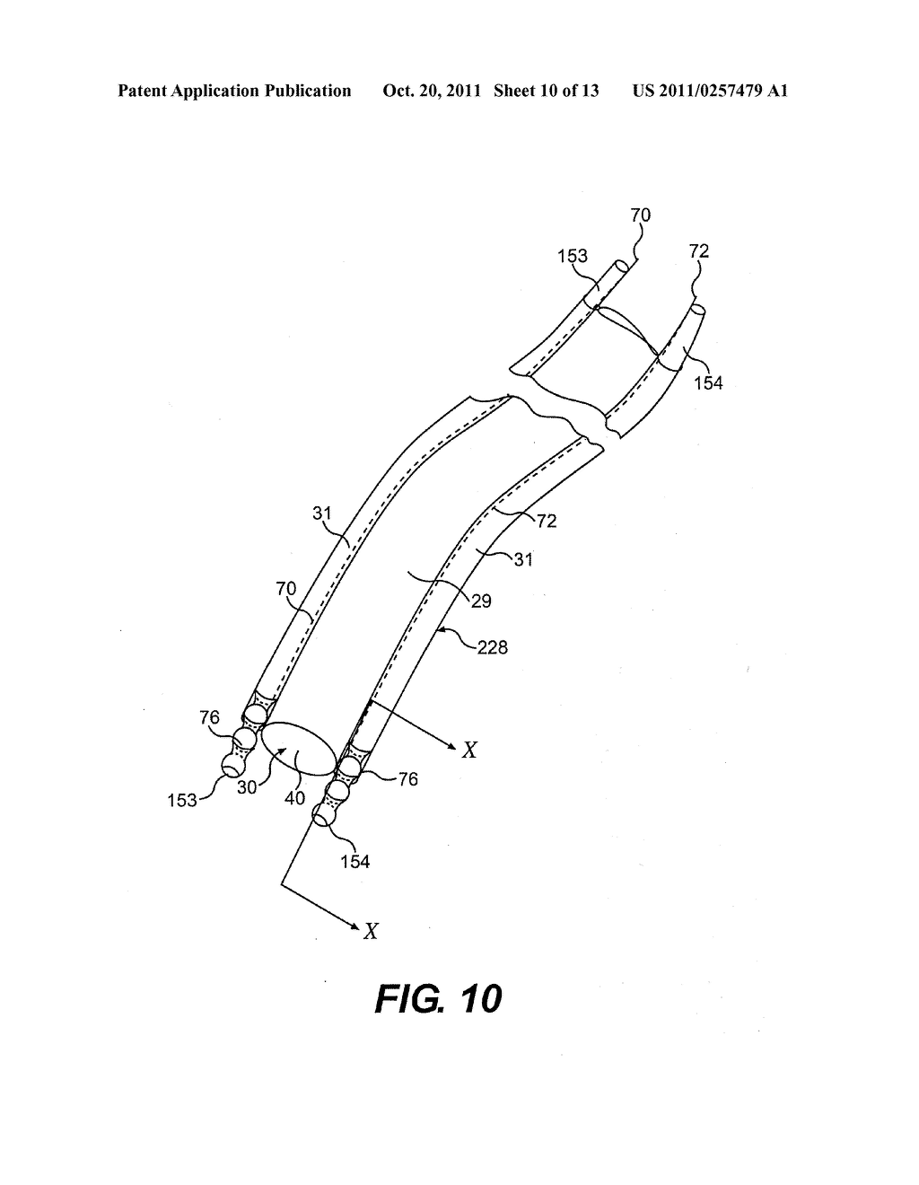 CONTROLLABLE ENDOSCOPIC SHEATH APPARATUS AND RELATED METHOD OF USE - diagram, schematic, and image 11