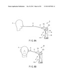 ENDOSCOPE diagram and image