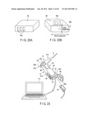 ENDOSCOPE diagram and image