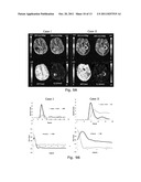 ESTIMATING AND CORRECTING FOR CONTRAST AGENT EXTRAVASATION IN TISSUE     PERFUSION IMAGING diagram and image