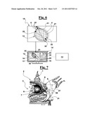 ULTRASONIC APPARATUS FOR MEASURING A LABOR PROGRESS PARAMETER diagram and image