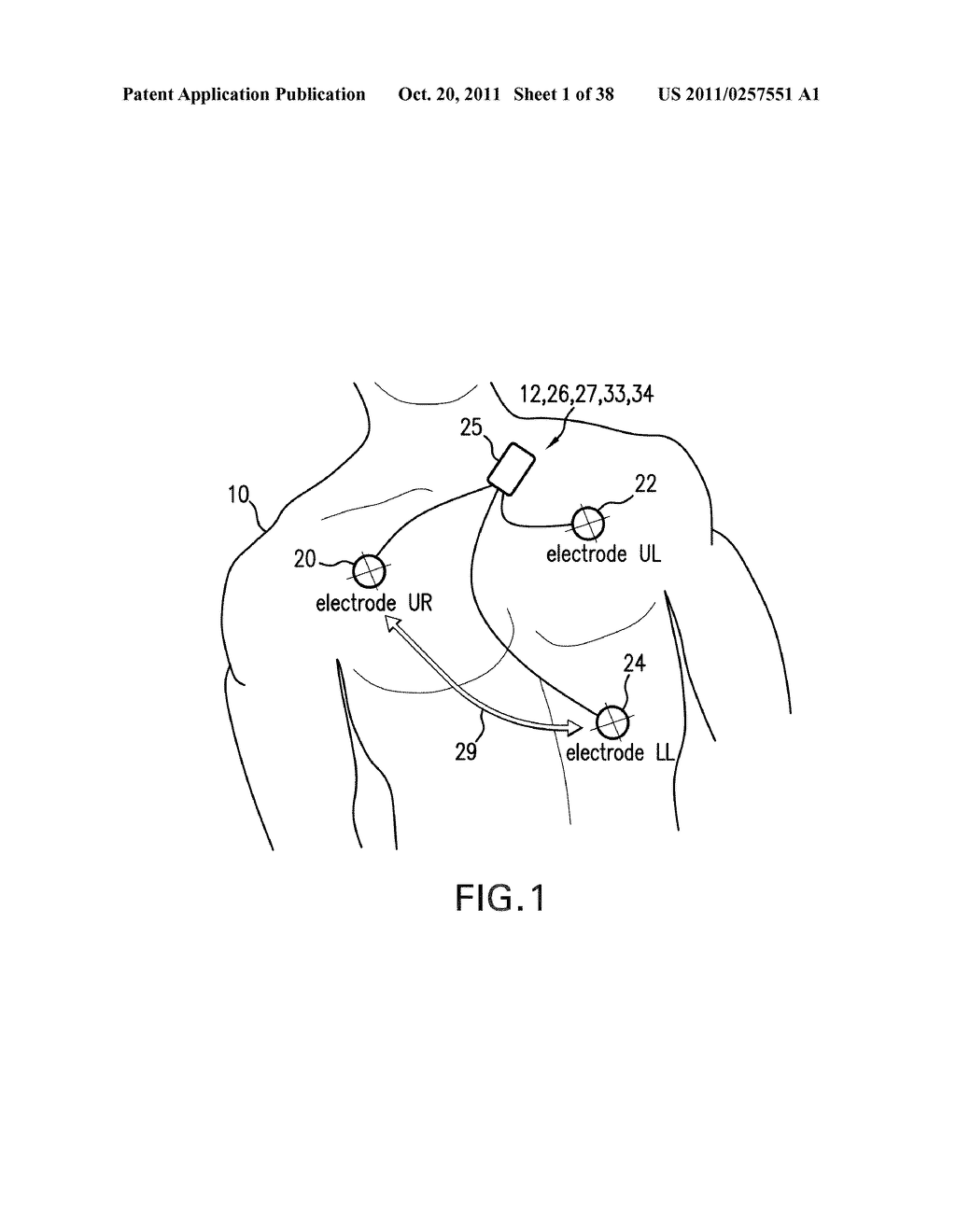 BODY-WORN MONITOR FOR MEASURING RESPIRATORY RATE - diagram, schematic, and image 02