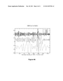 SYSTEMS AND METHODS FOR QUANTITATIVELY CHARACTERIZING SLOW WAVE ACTIVITIES     AND STATES IN SLEEP diagram and image