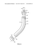 METHODS AND SYSTEMS FOR ABLATING TISSUE diagram and image