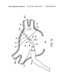 METHODS AND SYSTEMS FOR ABLATING TISSUE diagram and image