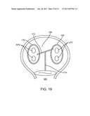 METHODS AND SYSTEMS FOR ABLATING TISSUE diagram and image