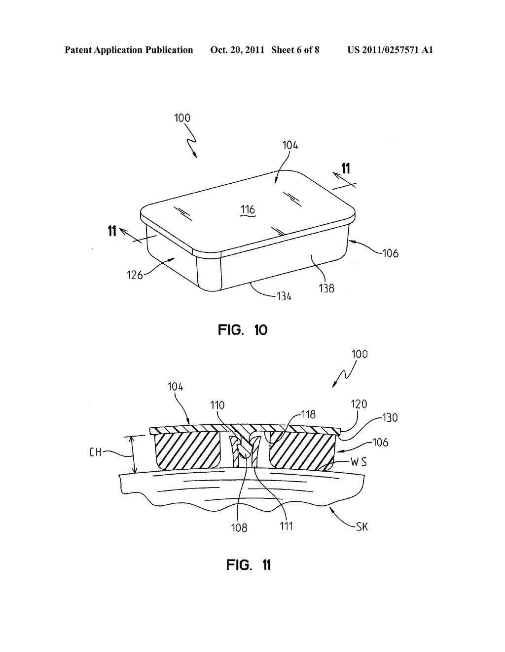 Post mountable BAHA bandage device - diagram, schematic, and image 07