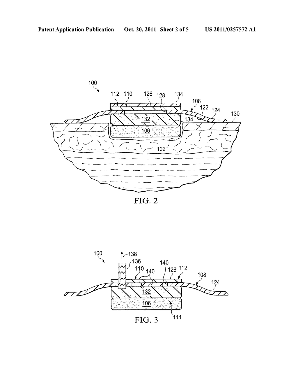 DRESSINGS AND METHODS FOR TREATING A TISSUE SITE ON A PATIENT - diagram, schematic, and image 03