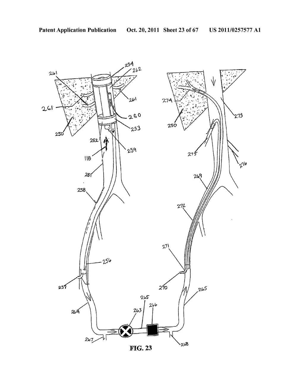 SYSTEMS, METHODS AND DEVICES FOR CIRCULATORY ACCESS - diagram, schematic, and image 24