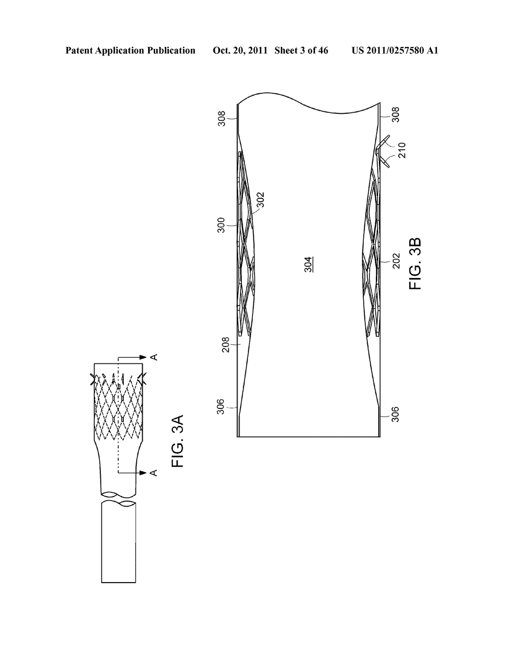 INTESTINAL SLEEVE - diagram, schematic, and image 04