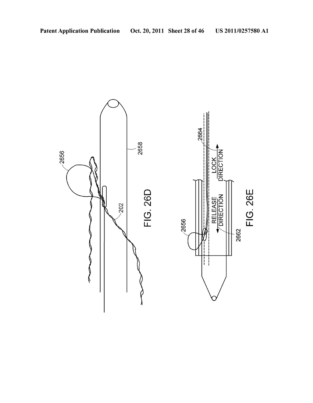 INTESTINAL SLEEVE - diagram, schematic, and image 29