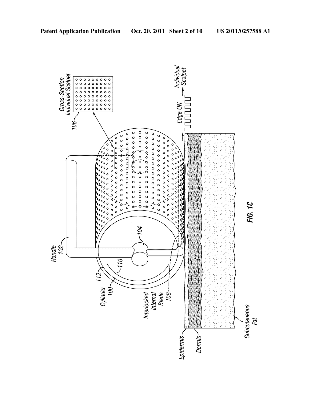 Skin treatment and drug delivery device - diagram, schematic, and image 03