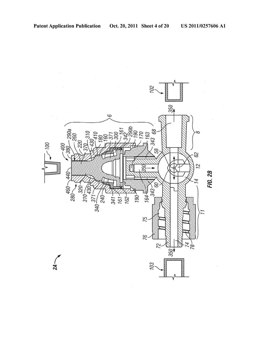 FLUID CONTROL DEVICE WITH VALVE AND METHODS OF USE - diagram, schematic, and image 05