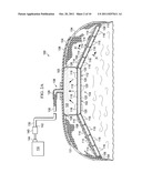 SYSTEMS, APPARATUSES, AND METHODS FOR SIZING A SUBCUTANEOUS,     REDUCED-PRESSURE TREATMENT DEVICE diagram and image