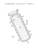 SYSTEMS, APPARATUSES, AND METHODS FOR SIZING A SUBCUTANEOUS,     REDUCED-PRESSURE TREATMENT DEVICE diagram and image