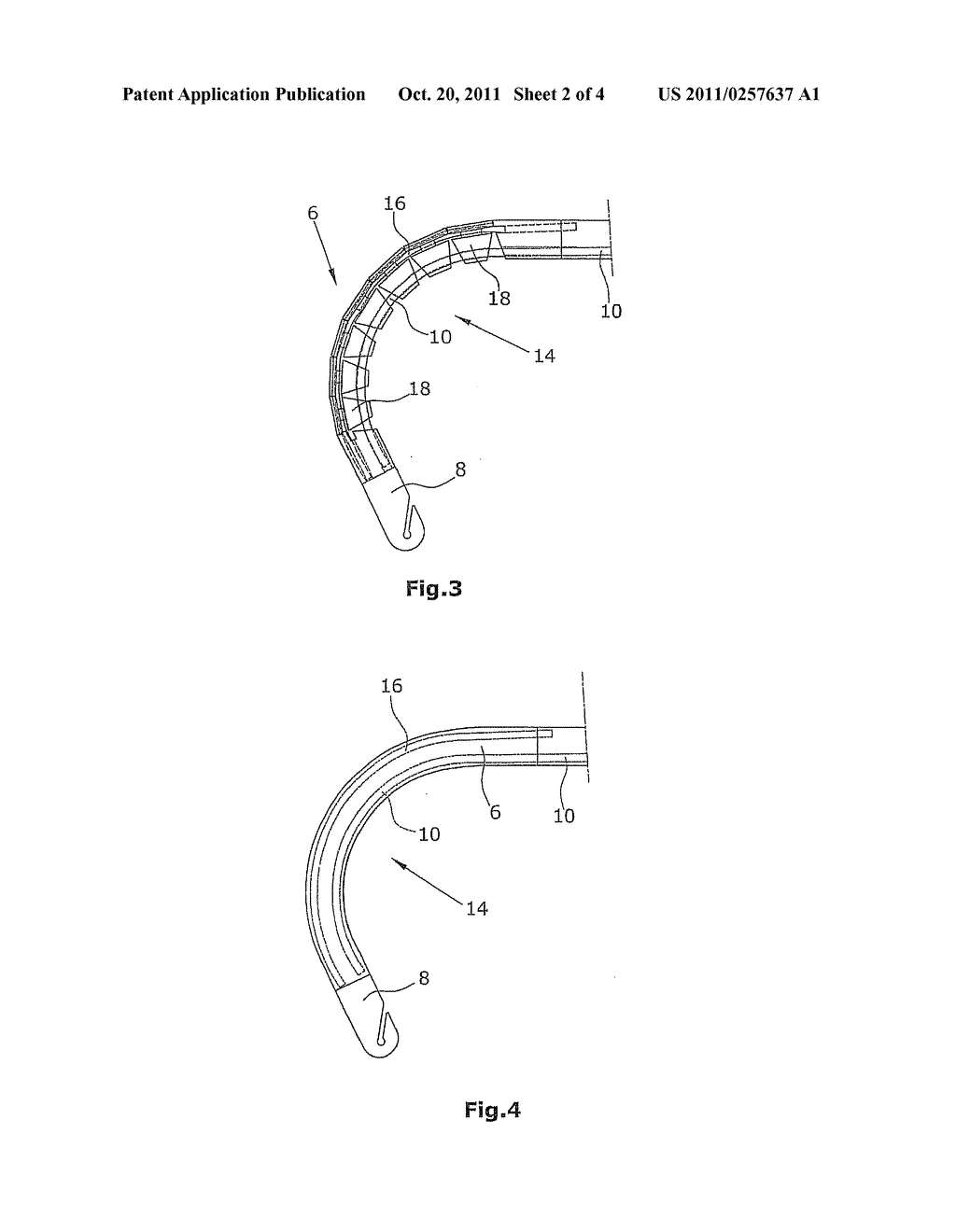 INSTRUMENT FOR LAPAROSCOPIC SURGERY - diagram, schematic, and image 03