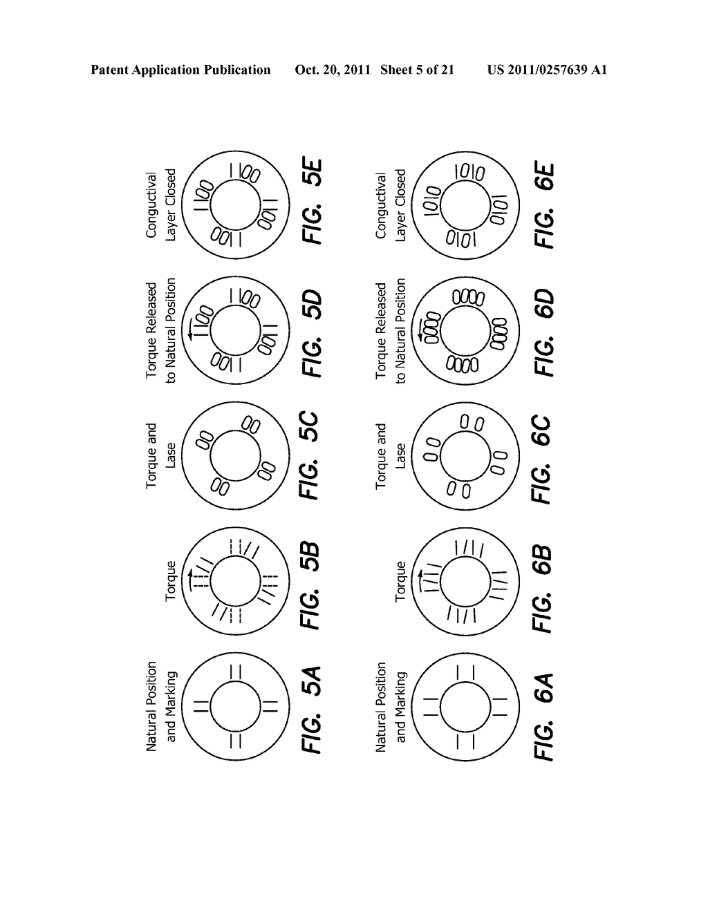 METHODS FOR TREATING EYE CONDITIONS - diagram, schematic, and image 06