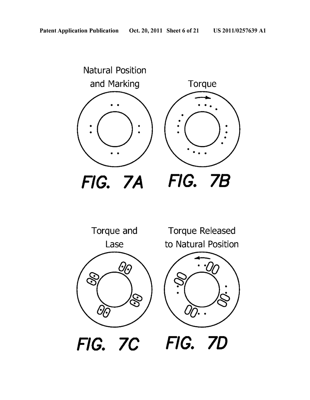 METHODS FOR TREATING EYE CONDITIONS - diagram, schematic, and image 07