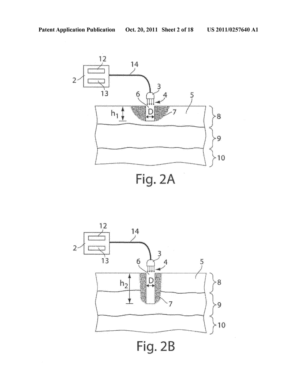 System and method for microablation of tissue - diagram, schematic, and image 03