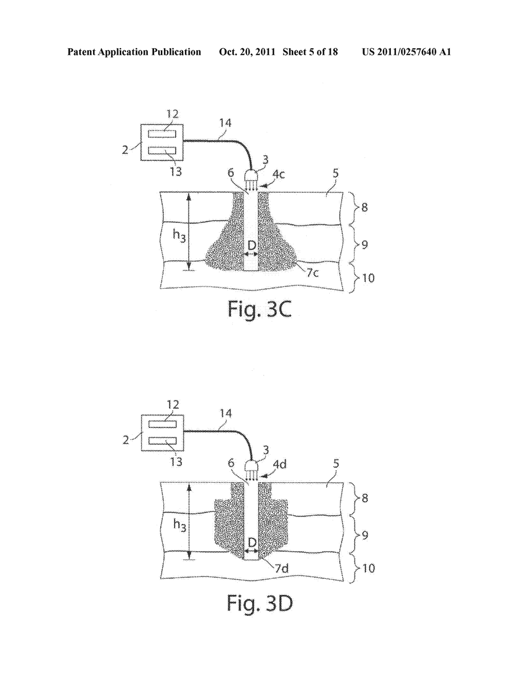System and method for microablation of tissue - diagram, schematic, and image 06