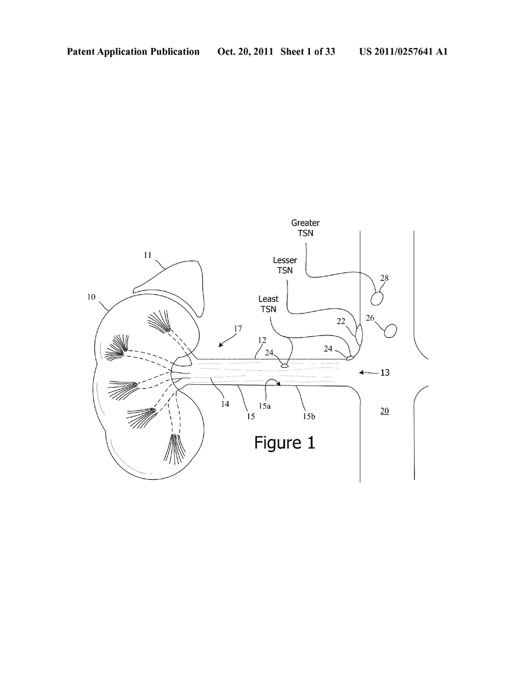 PHOTOTHERAPY FOR RENAL DENERVATION - diagram, schematic, and image 02