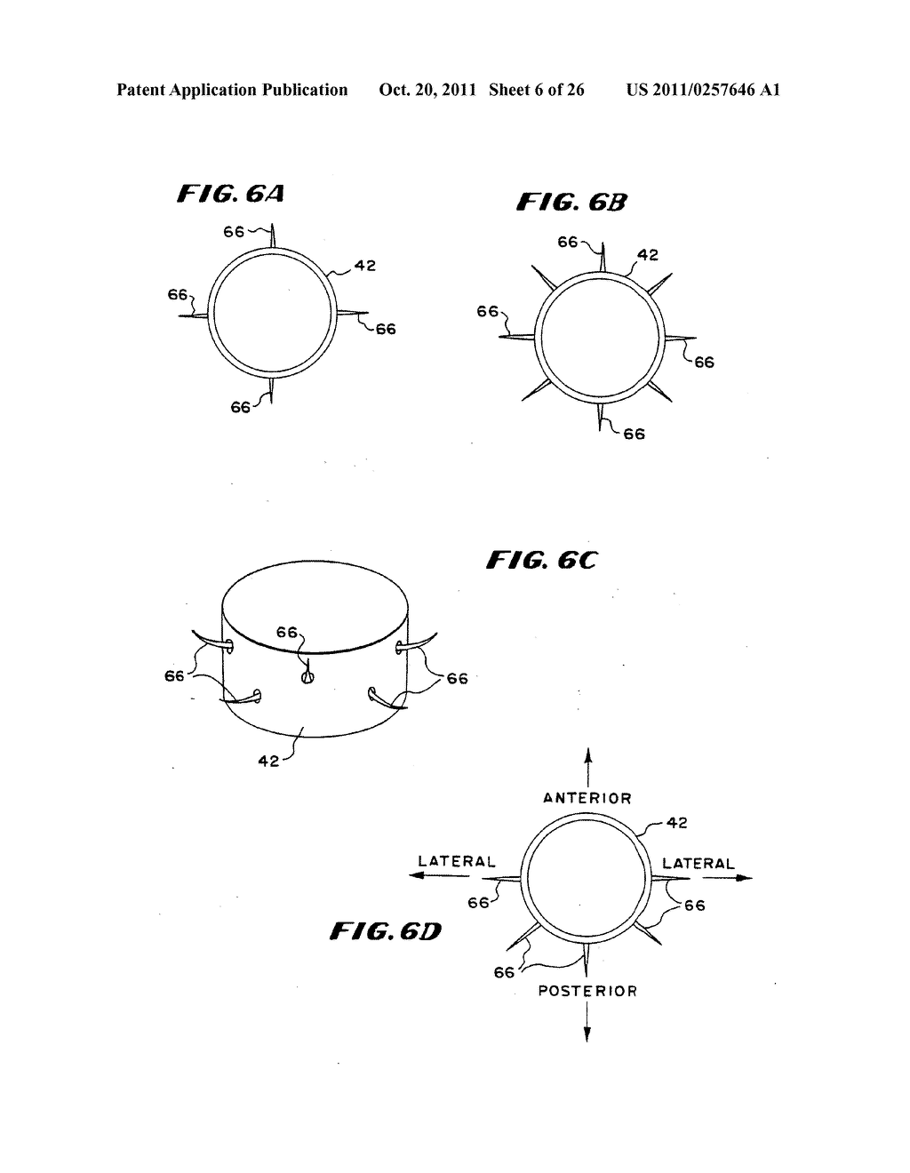 Method for treating fecal incontinence - diagram, schematic, and image 07