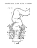 Method for treating fecal incontinence diagram and image