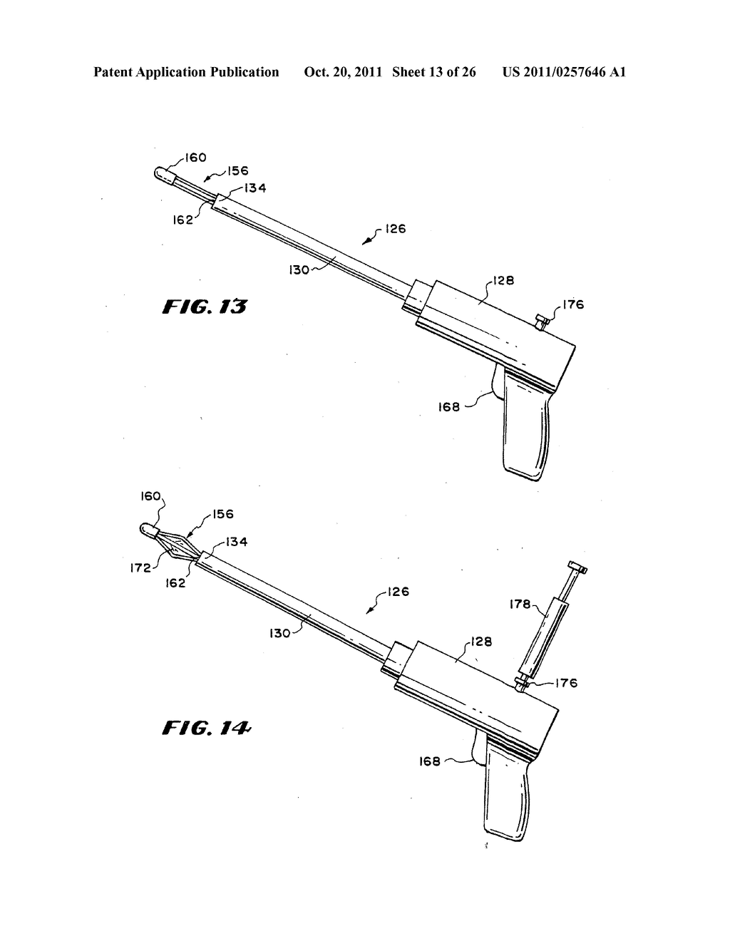 Method for treating fecal incontinence - diagram, schematic, and image 14