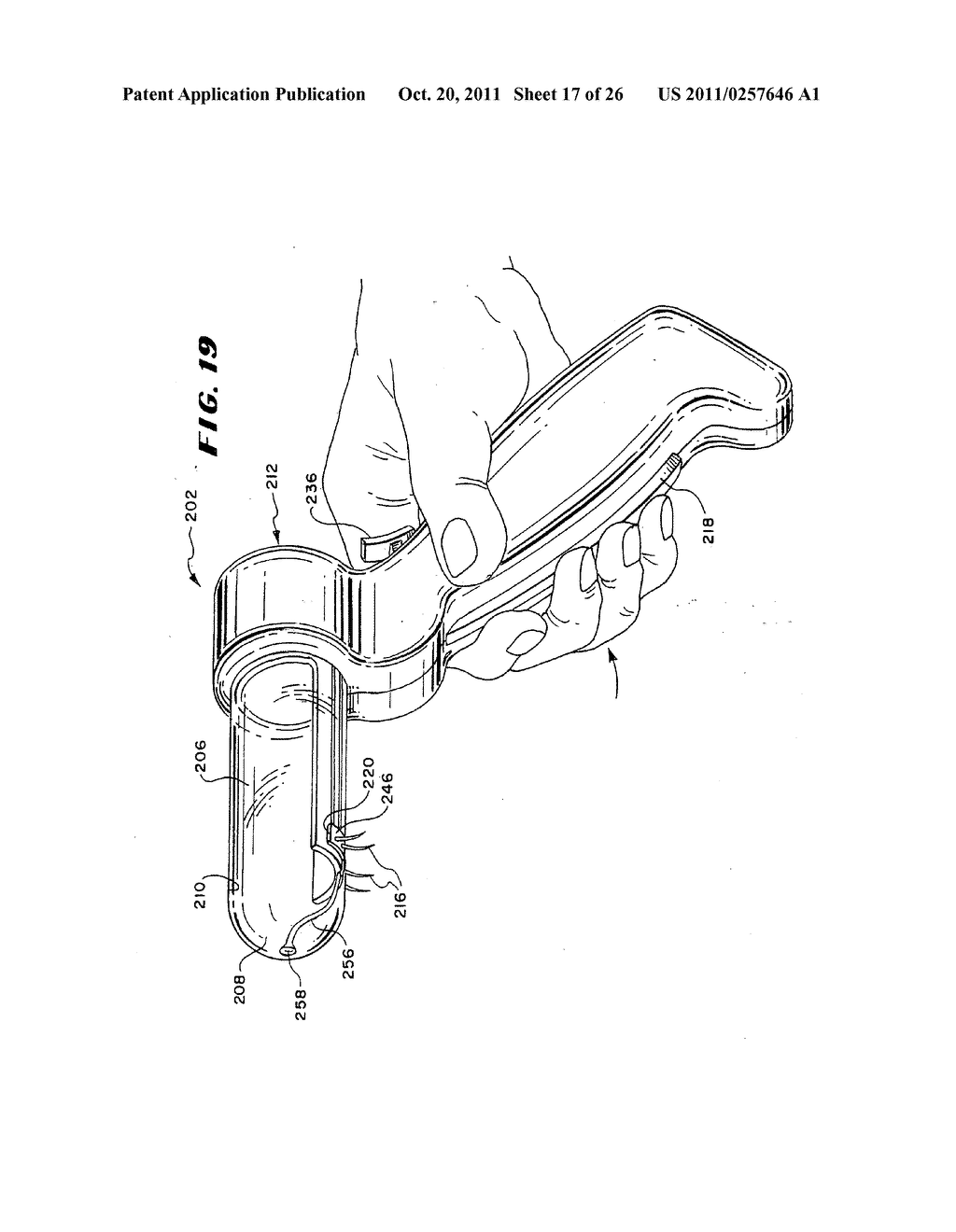 Method for treating fecal incontinence - diagram, schematic, and image 18