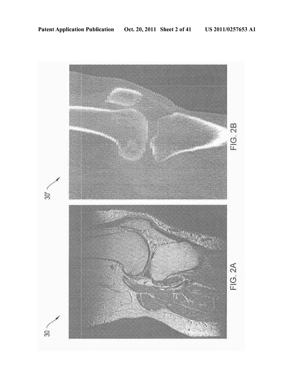 Systems and Methods for Patient-Based Computer Assisted Surgical     Procedures - diagram, schematic, and image 03