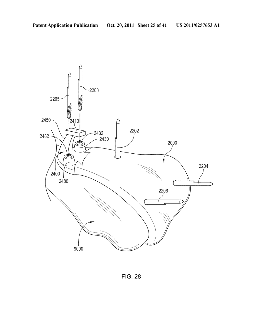 Systems and Methods for Patient-Based Computer Assisted Surgical     Procedures - diagram, schematic, and image 26