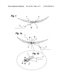 SUTURE SYSTEM FOR MANUAL AND ROBOTIC SURGERY WITH SUTURE THREAD GATHERER     AND FUSER AND DOUBLE POINTED SUTURE NEEDLE FOR ONE HAND APPLICATION (3) diagram and image