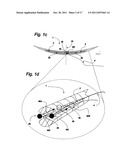 SUTURE SYSTEM FOR MANUAL AND ROBOTIC SURGERY WITH SUTURE THREAD GATHERER     AND FUSER AND DOUBLE POINTED SUTURE NEEDLE FOR ONE HAND APPLICATION (3) diagram and image