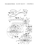 SUTURE SYSTEM FOR MANUAL AND ROBOTIC SURGERY WITH SUTURE THREAD GATHERER     AND FUSER AND DOUBLE POINTED SUTURE NEEDLE FOR ONE HAND APPLICATION (3) diagram and image