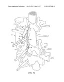 EXPANDABLE MEDICAL DEVICE AND METHOD diagram and image