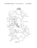 EXPANDABLE MEDICAL DEVICE AND METHOD diagram and image