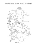 EXPANDABLE MEDICAL DEVICE AND METHOD diagram and image