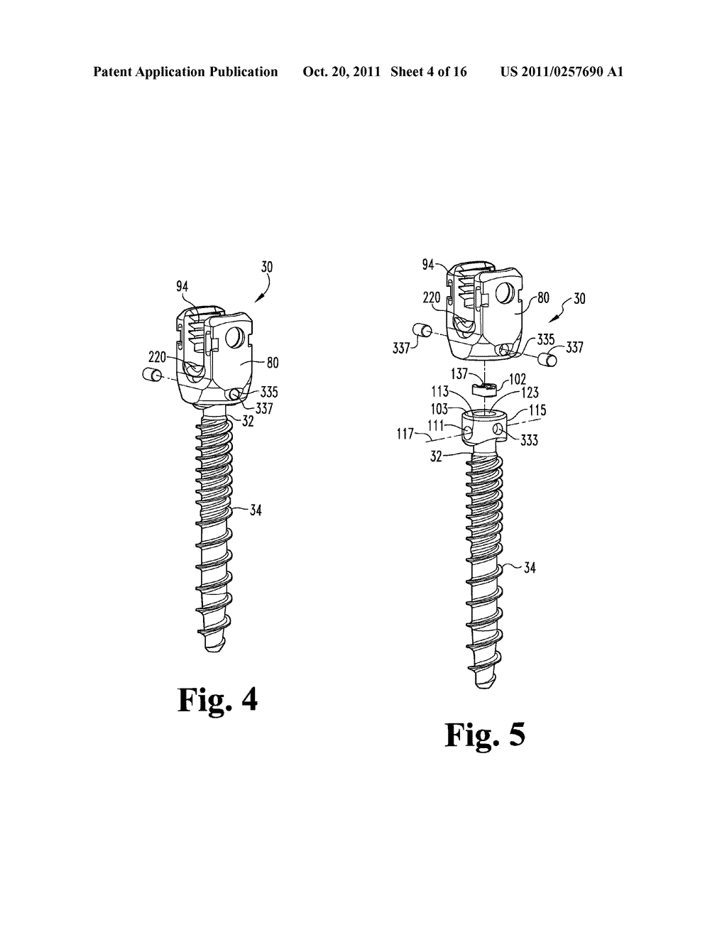 Transverse and Sagittal Adjusting Screw - diagram, schematic, and image 05