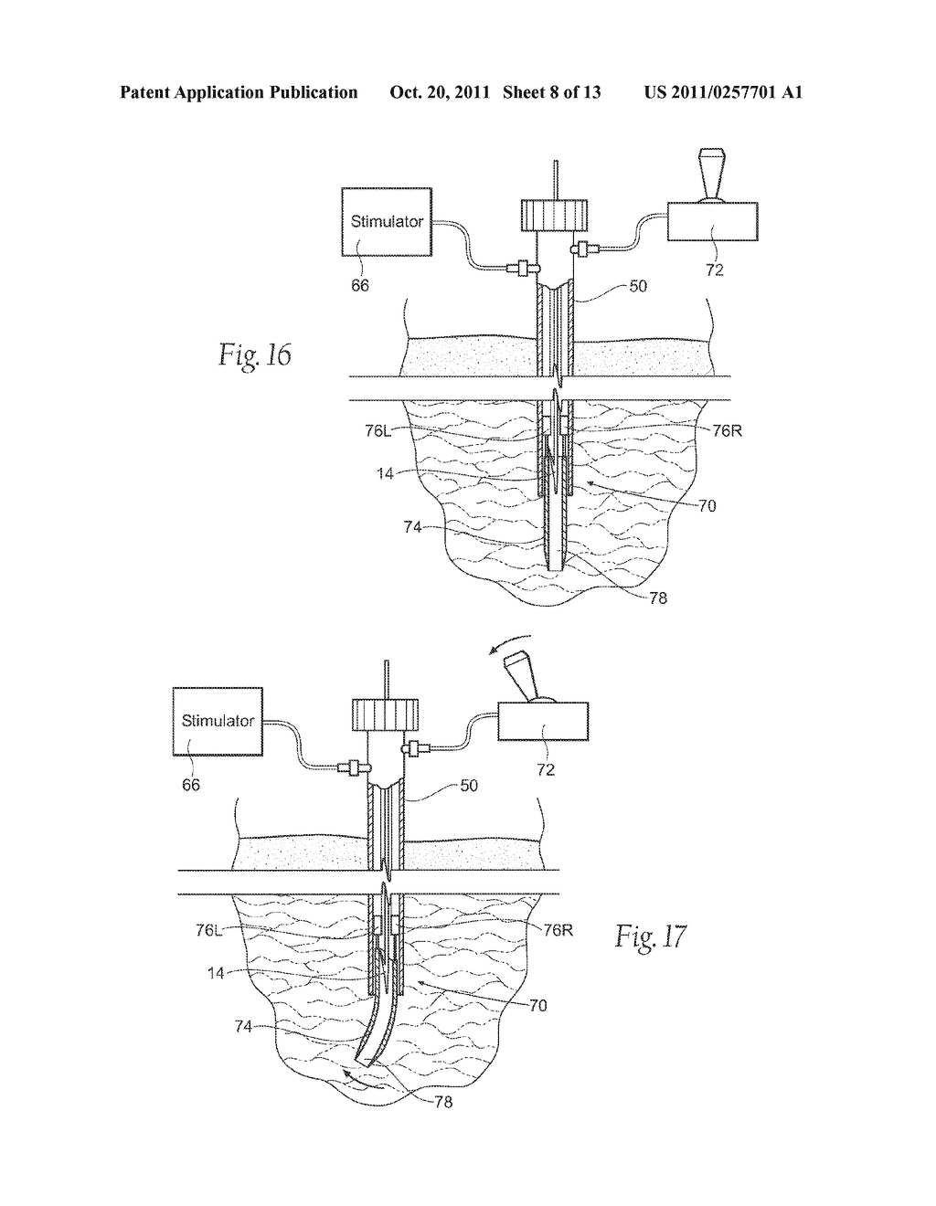 PORTABLE ASSEMBLIES, SYSTEMS AND METHODS FOR PROVIDING FUNCTIONAL OR     THERAPEUTIC NEUROSTIMULATION - diagram, schematic, and image 09