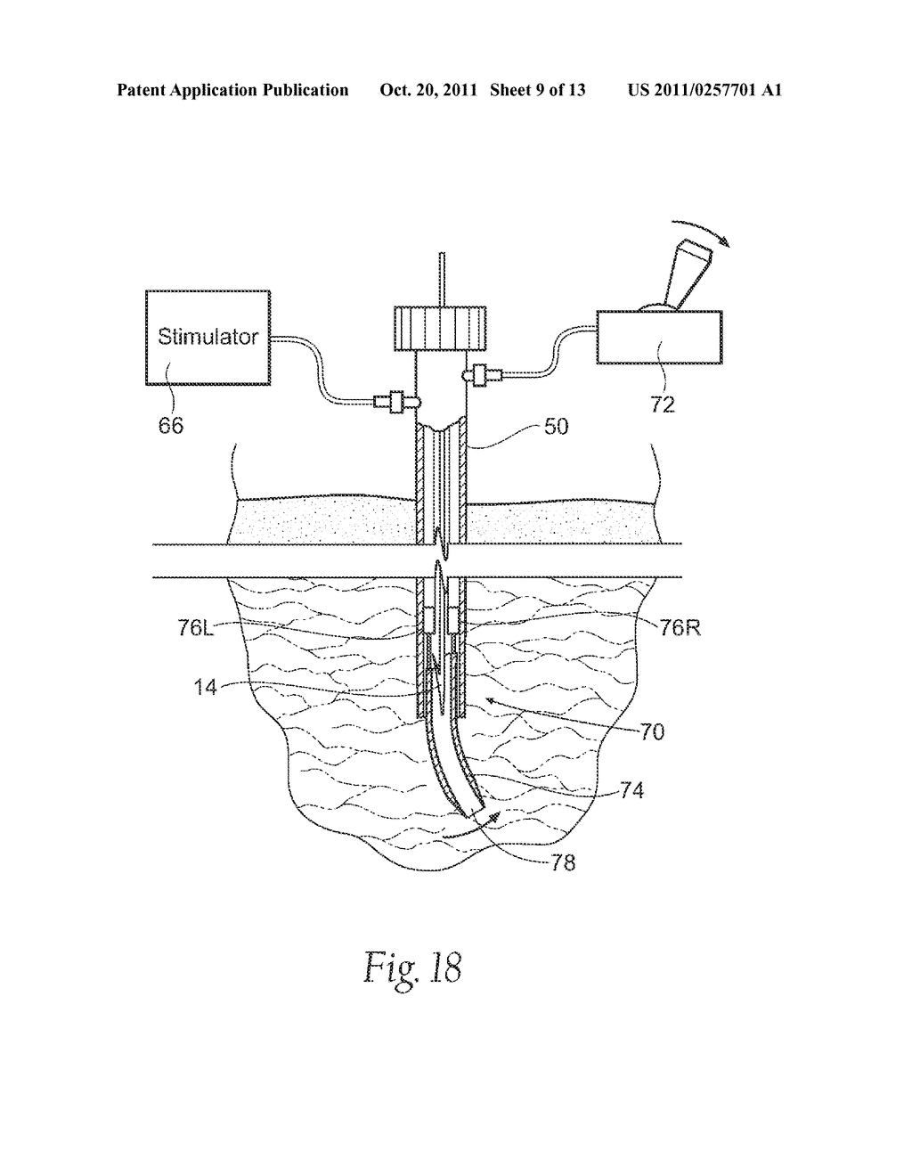 PORTABLE ASSEMBLIES, SYSTEMS AND METHODS FOR PROVIDING FUNCTIONAL OR     THERAPEUTIC NEUROSTIMULATION - diagram, schematic, and image 10