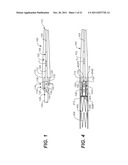 Controlled Tip Release Stent Graft Delivery System and Method diagram and image