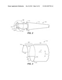 Controlled Tip Release Stent Graft Delivery System and Method diagram and image