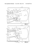 Controlled Tip Release Stent Graft Delivery System and Method diagram and image