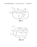 Controlled Tip Release Stent Graft Delivery System and Method diagram and image