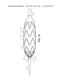 Controlled Tip Release Stent Graft Delivery System and Method diagram and image