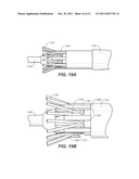 Controlled Tip Release Stent Graft Delivery System and Method diagram and image