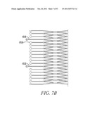 DEVICES AND METHODS FOR CORONARY SINUS PRESSURE RELIEF diagram and image