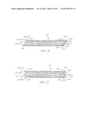 DEVICES AND METHODS FOR CORONARY SINUS PRESSURE RELIEF diagram and image