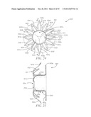 DEVICES AND METHODS FOR CORONARY SINUS PRESSURE RELIEF diagram and image